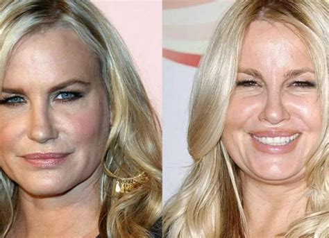 jennifer coolidge before plastic surgery|Jennifer Coolidge: A Look Before Plastic Surgery